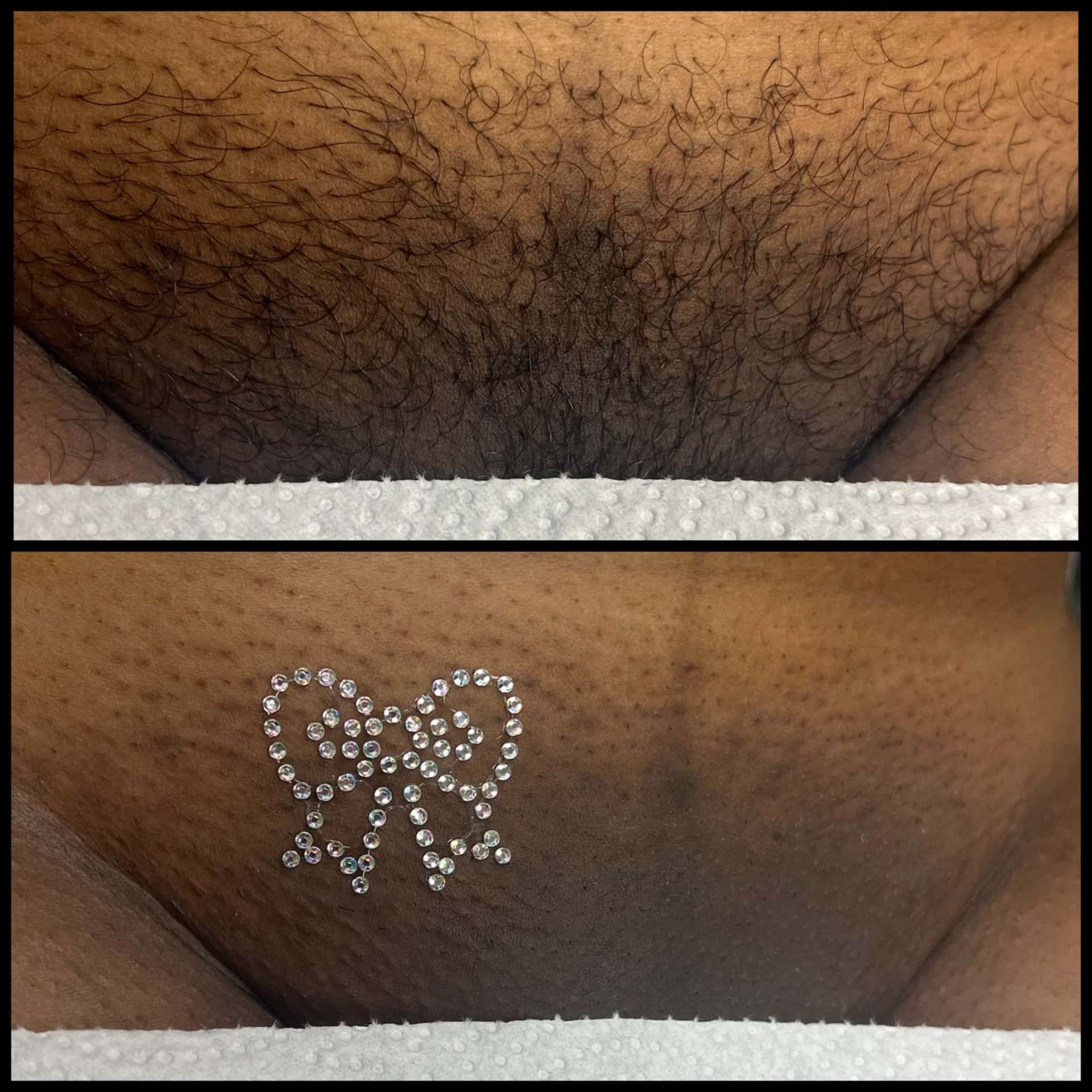 Brazilian wax before and after at Opal Skin Studios